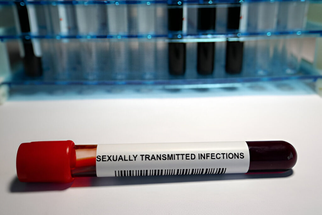 std test in dubai