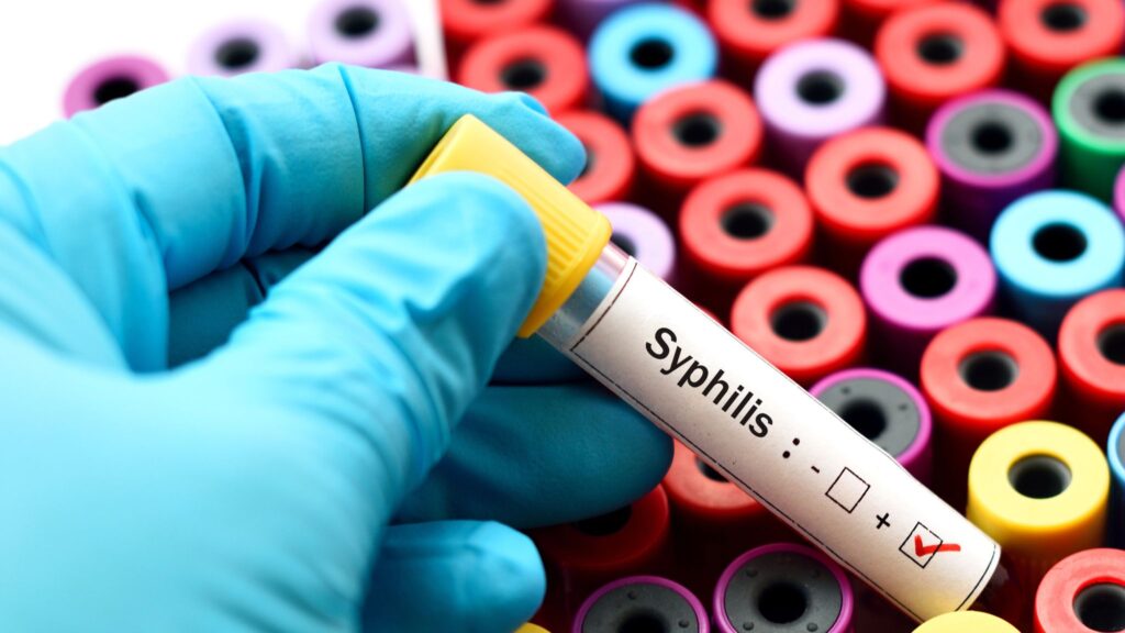 Syphilis Test in dubai