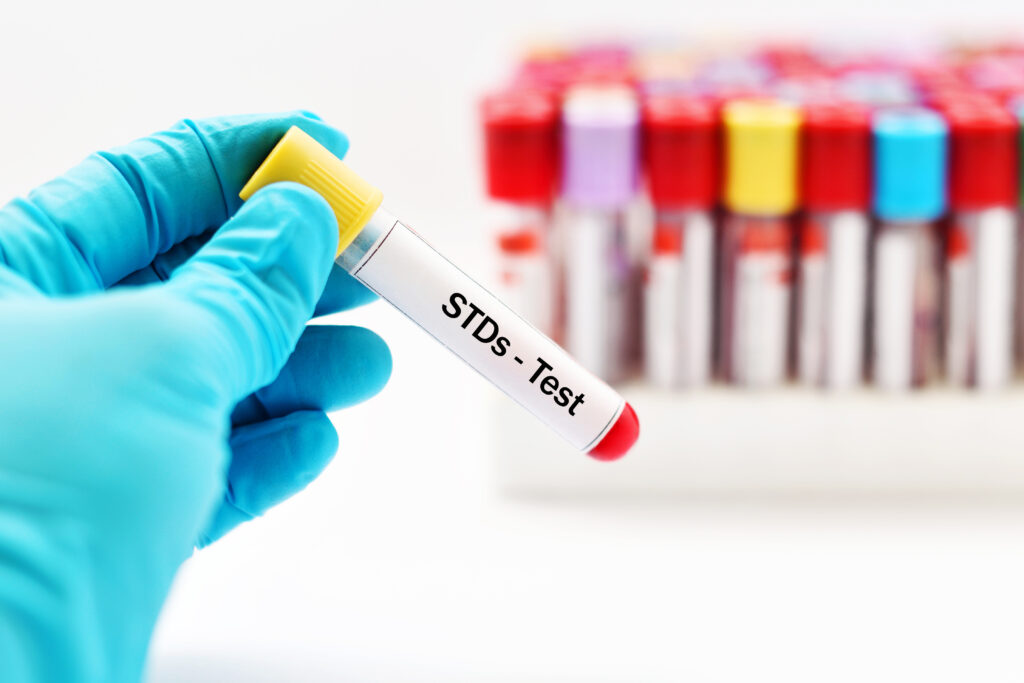 STD test in dubai