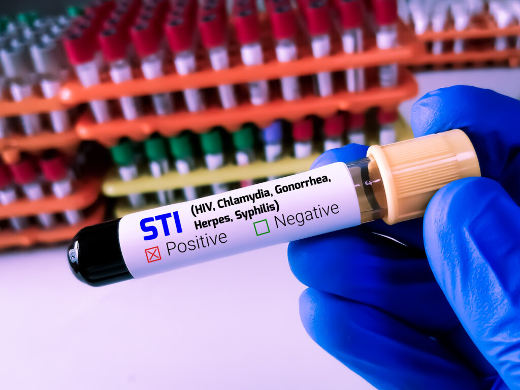 STD Test in Dubai