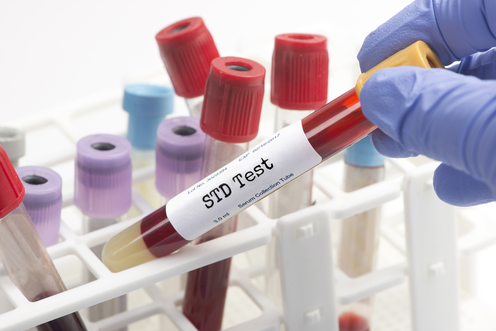 STI Testing service in Dubai
