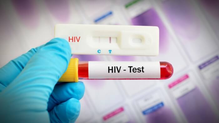 HIV test Dubai