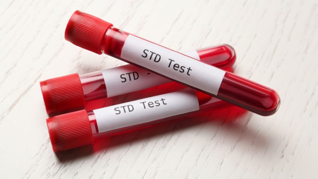 STD test at Home