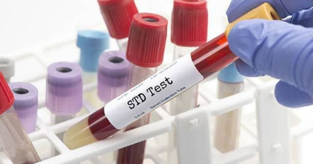 STD test at home Dubai