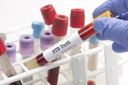 STD testing in Dubai