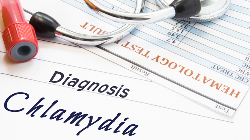 Chlamydia Treatment Dubai