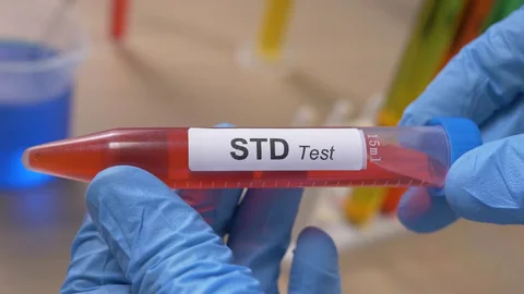 at home STD test