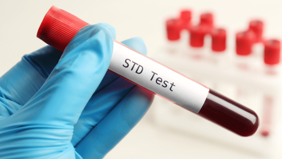 at‑home STD test