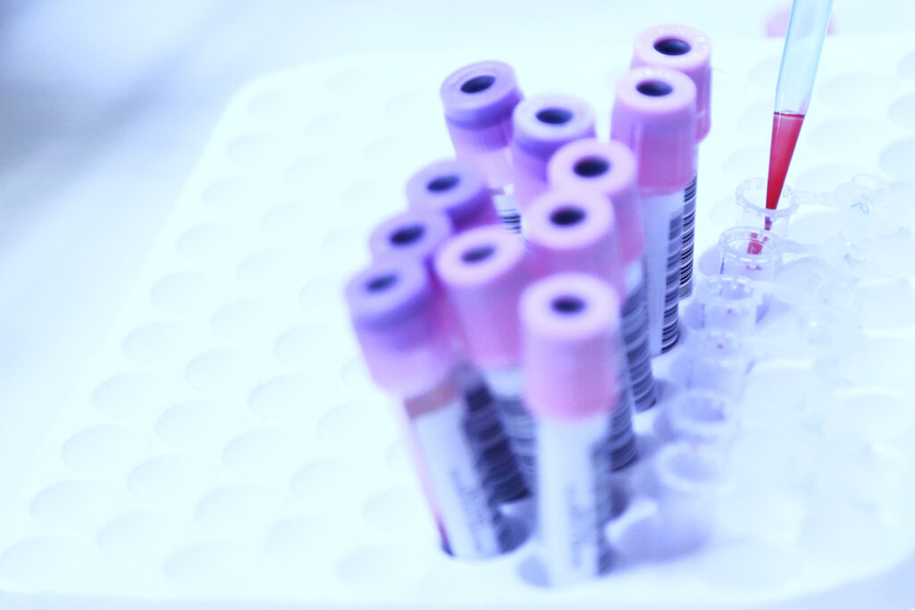 std blood test dubai