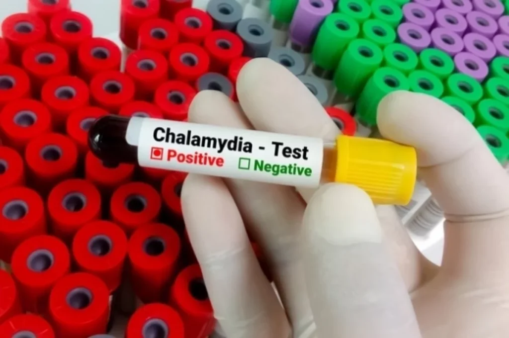 Chlamydia treatment in Dubai