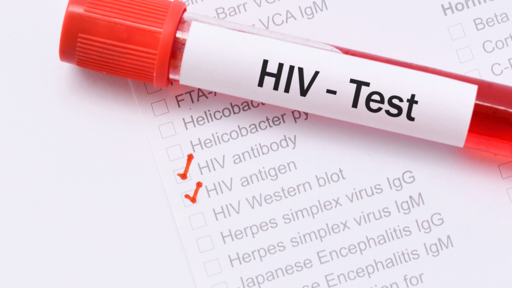 HIV tests in Dubai
