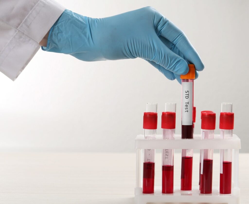 STD test done at home in Dubai