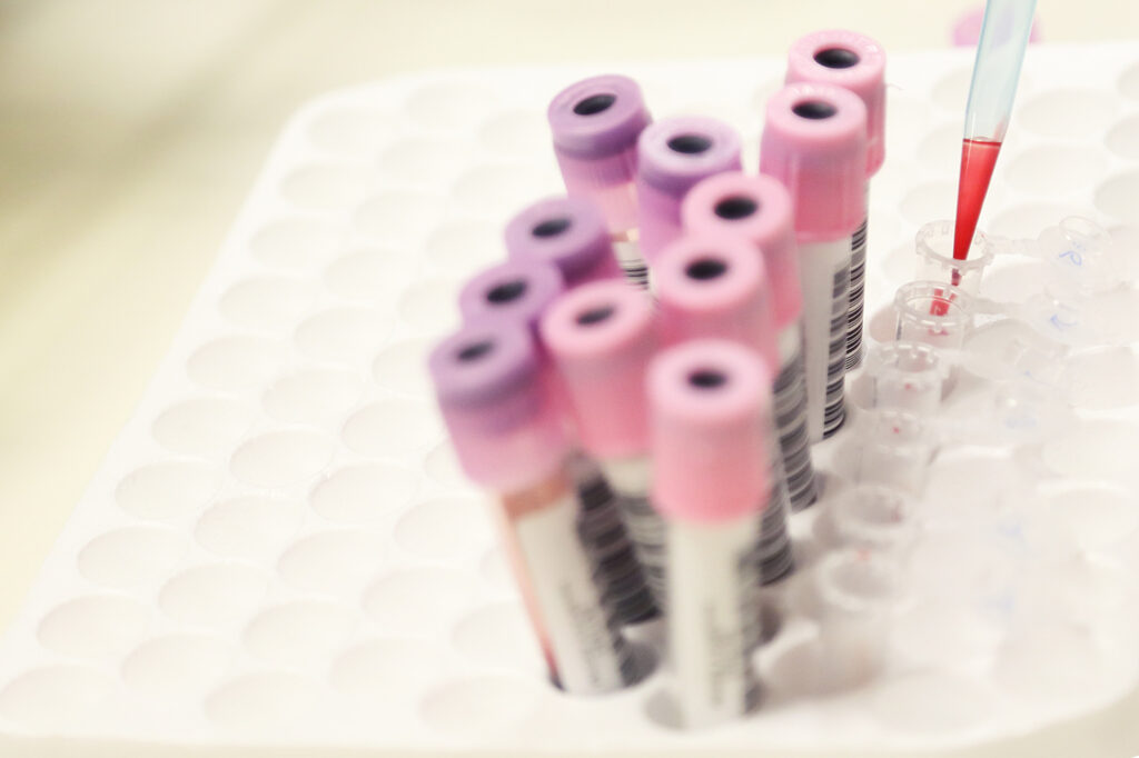 std full panel testing