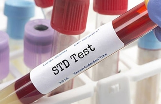 STD test Dubai