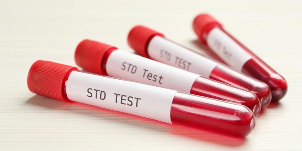 STD testing in Dubai
